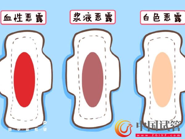盤點(diǎn)產(chǎn)后惡露會(huì)有幾種顏色，出現(xiàn)黑色就需注意了！(圖1)