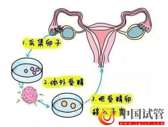 新一代試管嬰兒技術(shù)發(fā)布！專家：每年可多生10萬以上嬰兒(圖3)