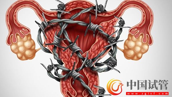 女性想要保護(hù)卵巢健康這些事要做好(圖2)