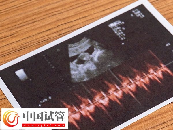 杭州正規(guī)促排醫(yī)院排名公布，浙江省婦保醫(yī)院綜合第一(圖1)