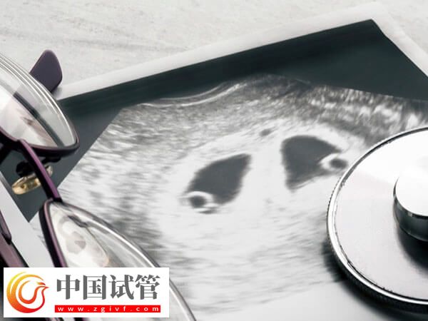 殘角子宮助孕選成都哪家醫(yī)院好？對比成功率選更放心(圖2)