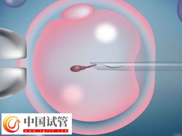 49歲高齡做試管嬰兒易生化，染色體異常是主要原因(圖2)