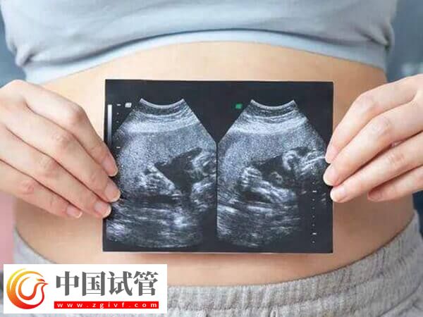 懷雙胞胎的產(chǎn)前準(zhǔn)備有哪些(圖1)