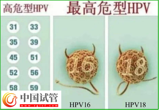 通過hpv報告單圖片怎么判斷自己是正常的呢？(圖3)