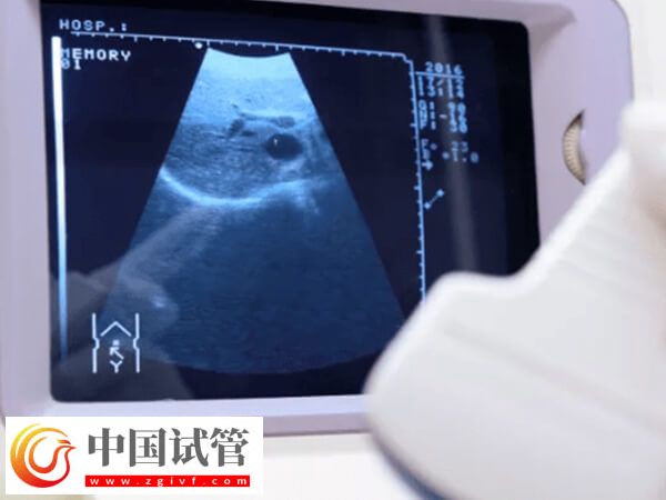 試管嬰兒查體到移植至少2個(gè)月，期間做好這些更容易成功(圖2)