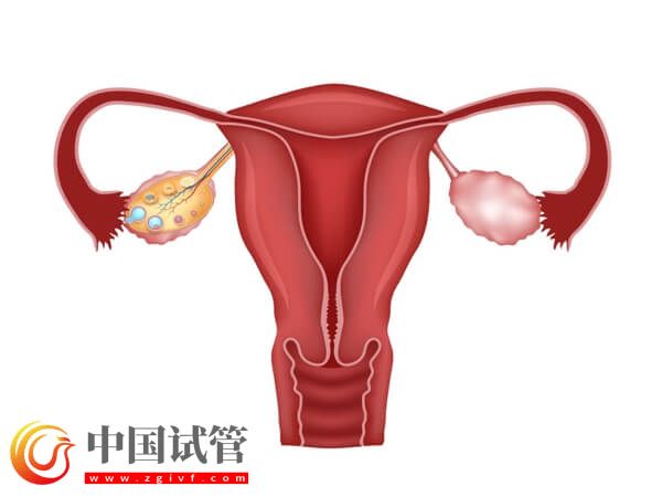 沒有子宮能生孩子嗎(圖8) 沒有子宮能生孩子嗎(圖8)