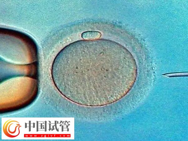 廣州市第一人民醫(yī)院試管嬰兒價(jià)格，養(yǎng)囊4千起(圖1)