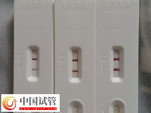 青島婦女兒童醫(yī)院助孕科普，內(nèi)附開展項(xiàng)目及成功率(圖3)