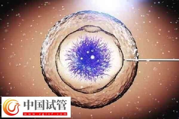 一代試管嬰兒受精失敗精卵不結合的原因有哪些？(圖1)