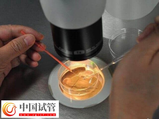 胚胎培養(yǎng)液對(duì)試管嬰兒有沒(méi)有影響(圖1)
