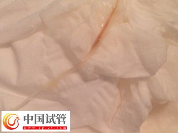 試管嬰兒囊胚移植10天只有淺粉有機會，時間不一也正常(圖1)