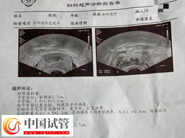 試管移植后一超二超三超時(shí)間多久(圖1)