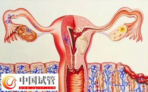 子宮內(nèi)膜厚度多少做試管嬰兒才能成功著床？(圖3)