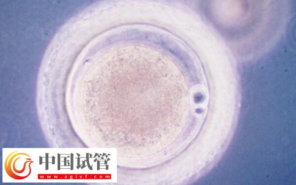 一級(jí)胚胎是不是很難得(圖1)