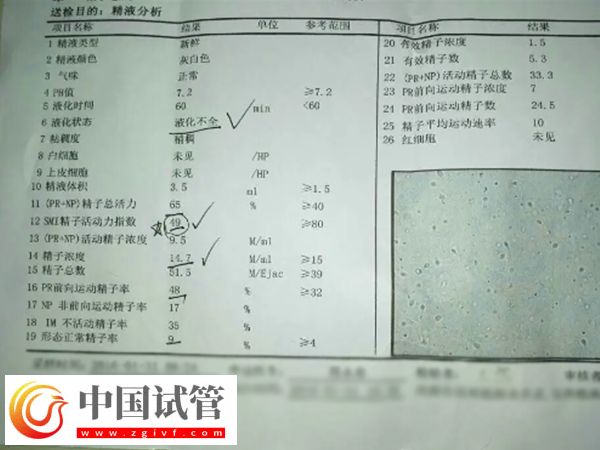 河南省人民醫(yī)院做試管嬰要準備什么(圖2)