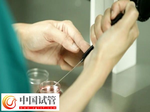 試管移植成功的經(jīng)驗有哪些(圖1)