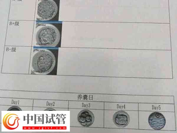 試管養(yǎng)囊成功的是否都是優(yōu)胚(圖1)