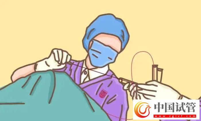 試管嬰兒有哪些出乎意料的概念？(圖4)