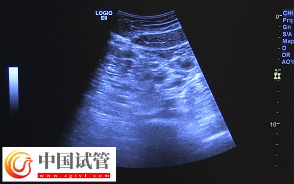 咸寧市中心醫(yī)院監(jiān)測卵泡多少錢(圖1)