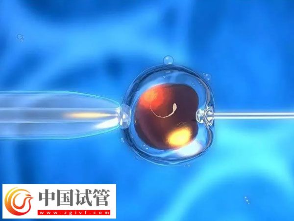 杭州省婦保醫(yī)院和市一醫(yī)院做試管哪個好(圖2)