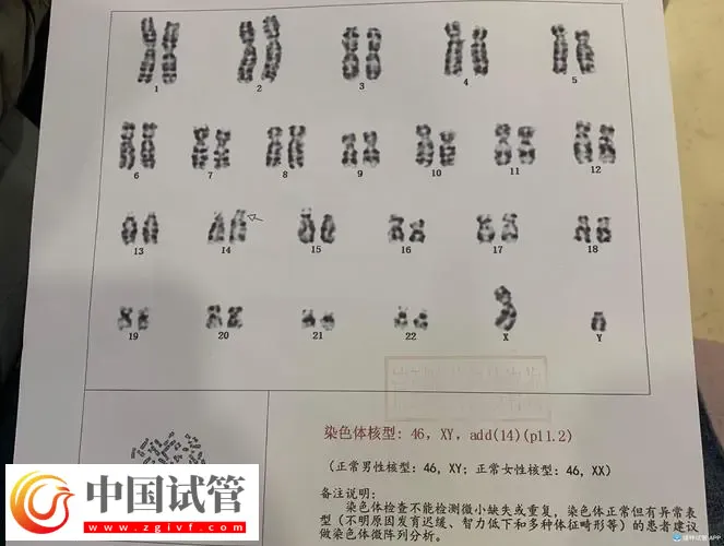 廣州做染色體檢查多少錢？廣東省婦幼保健院約230-3300元左右(圖2)