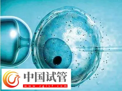 北京做供卵試管不用排隊的醫(yī)院有哪些？這些公立醫(yī)院紛紛上榜(圖3)