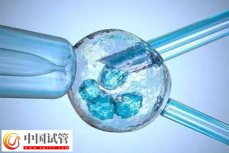北京試管助孕大概要多少錢(qián)？這是2024最新收費(fèi)標(biāo)準(zhǔn)(圖3)