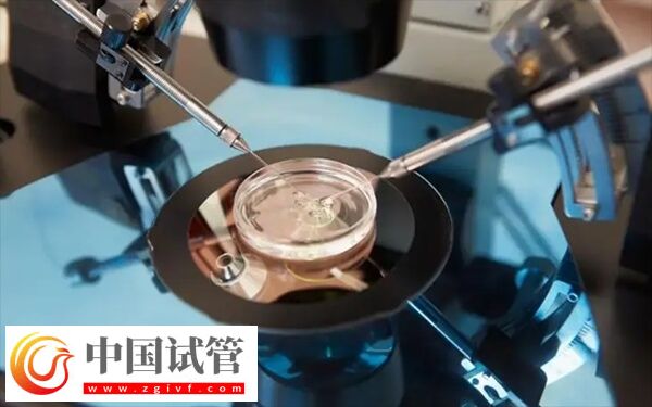 試管移植當(dāng)天需要注意什么(圖1)