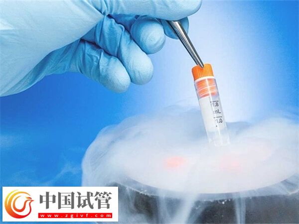 試管凍精費(fèi)用是多少(圖1)