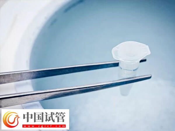 試管凍精費(fèi)用是多少(圖2)