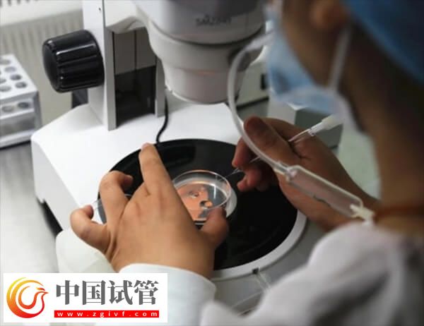 胚胎質(zhì)量一般是移植還是促排好(圖2)