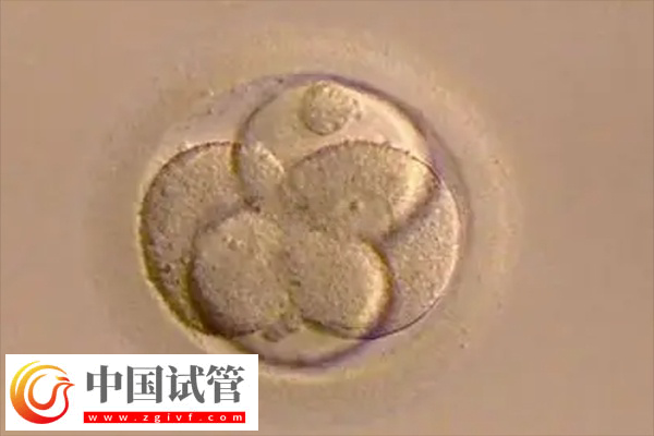 試管原腸胚能不能進(jìn)行胚胎移植手術(shù)(圖1)