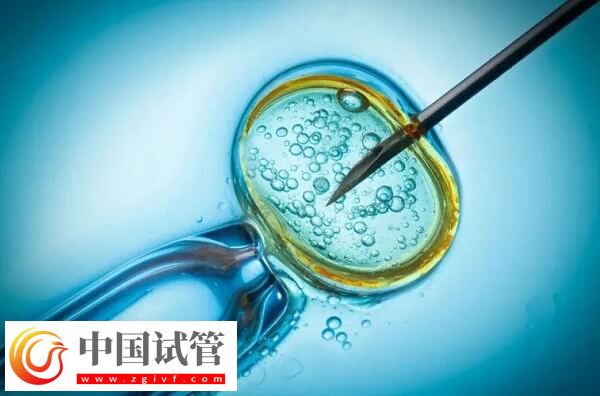 試管嬰兒是不是容易引發(fā)早產(chǎn)(圖2)