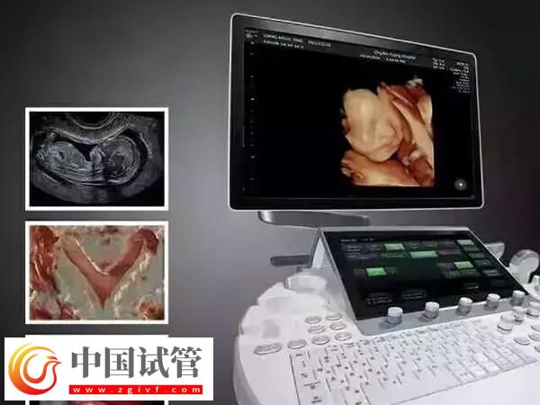 鷹潭公立三甲醫(yī)院做一次四維彩超多少錢？(圖1)