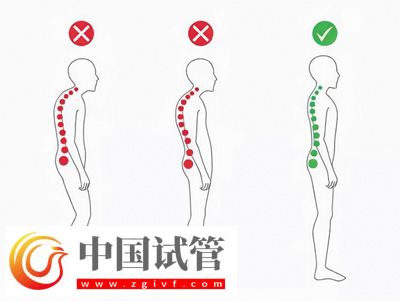 不良體態(tài)正悄悄損害你的健康(圖1)