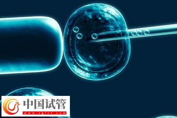 試管移植反復(fù)不著床需要查什么(圖1)