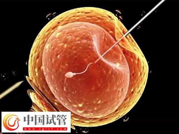 松原能做一代試管的三甲醫(yī)院是哪家？(圖1)