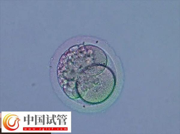 做試管月經(jīng)不規(guī)律的移植方案分享，激素替代周期為其一(圖2)