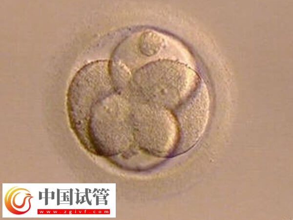 試管嬰兒移植前胚胎如何評(píng)分(圖1)