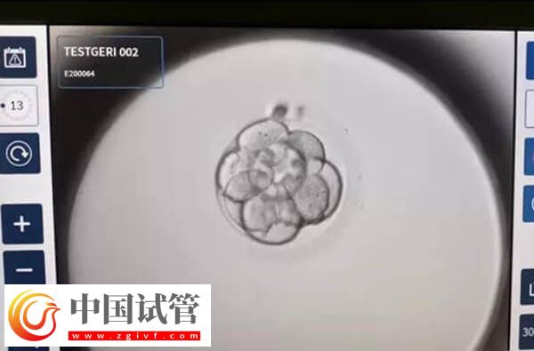 做二代試管為什么老配成c級(jí)胚胎(圖1)