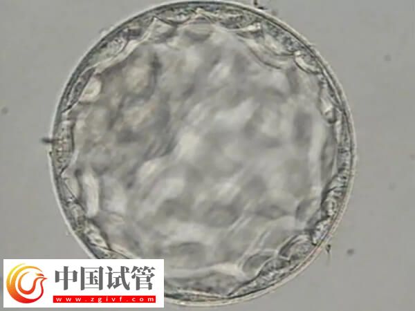 胚胎8細(xì)胞三級(jí)是不是比5細(xì)胞好(圖2)