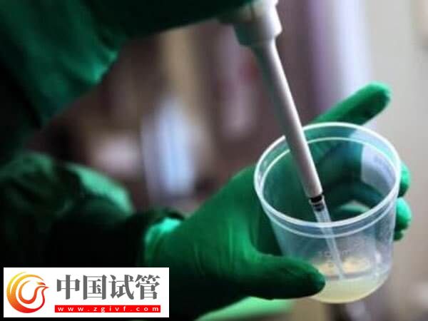 艾滋病洗精費(fèi)用是多少(圖2)