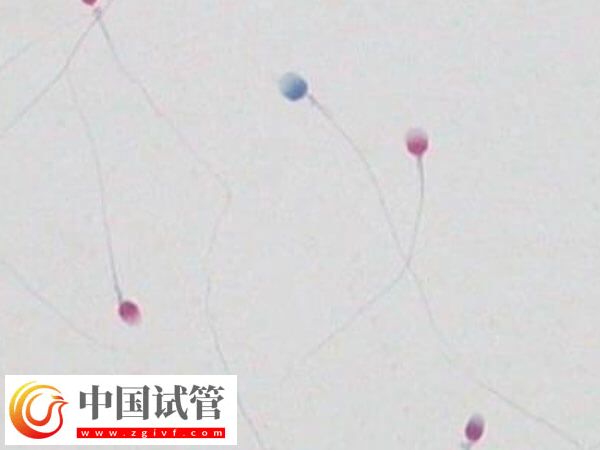 精子碎片報(bào)告是什么樣的(圖1)