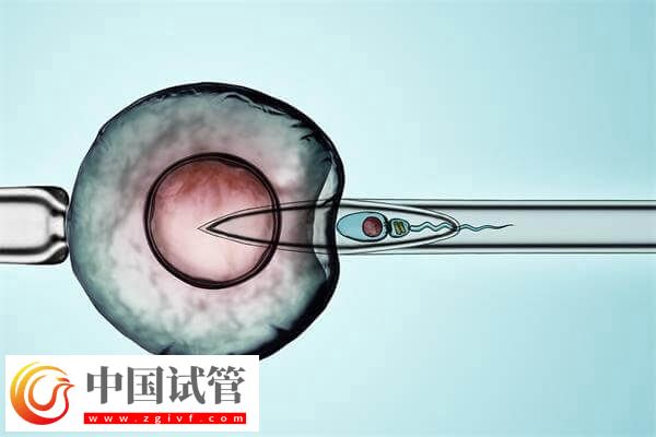 試管嬰兒改良長(zhǎng)方案促排卵有哪些優(yōu)缺點(diǎn)？(圖1)