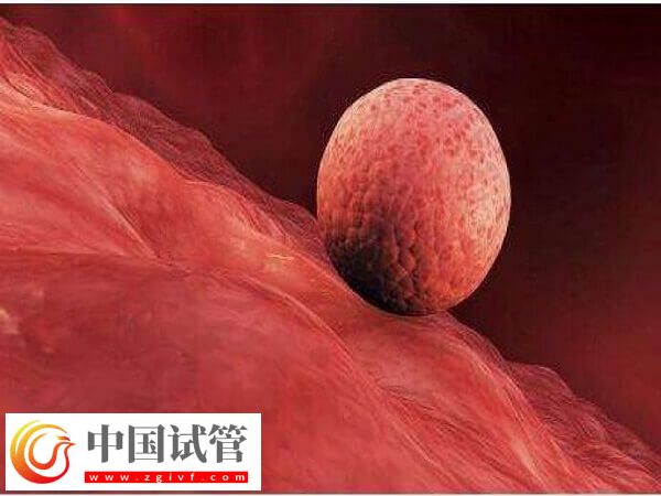 囊胚移植到子宮之后的狀態(tài)是直接著床還是先游離？(圖1)