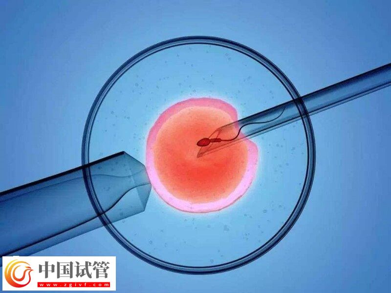 人工授精跟試管嬰兒有什么區(qū)別(圖1) 人工授精跟試管嬰兒有什么區(qū)別(圖1)