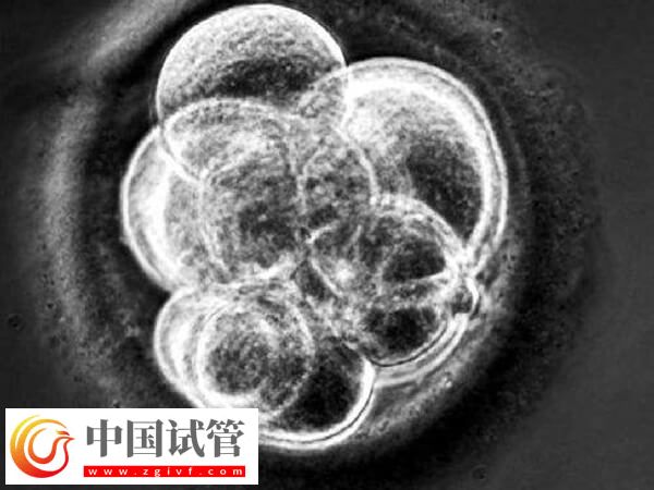 為什么三代試管胚胎優(yōu)質(zhì)不著床(圖1) 為什么三代試管胚胎優(yōu)質(zhì)不著床(圖1)