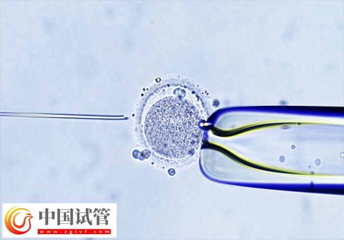 試管嬰兒助孕有幾個(gè)階段(圖1) 試管嬰兒助孕有幾個(gè)階段(圖1)