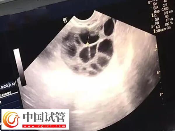 試管嬰兒助孕有幾個(gè)階段(圖2) 試管嬰兒助孕有幾個(gè)階段(圖2)